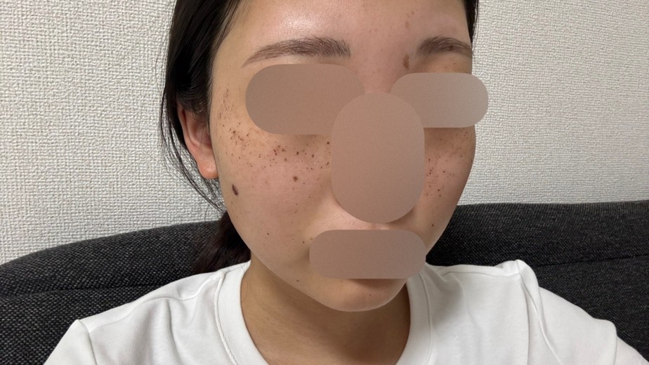 after photo: ルメッカ