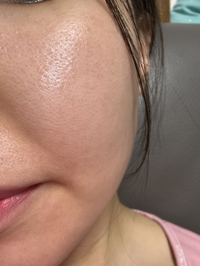 before photo: 포텐자