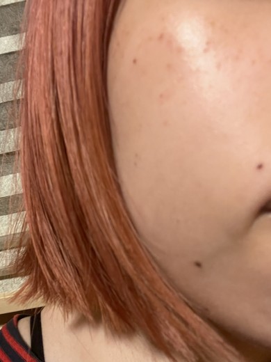 after photo: ルメッカ