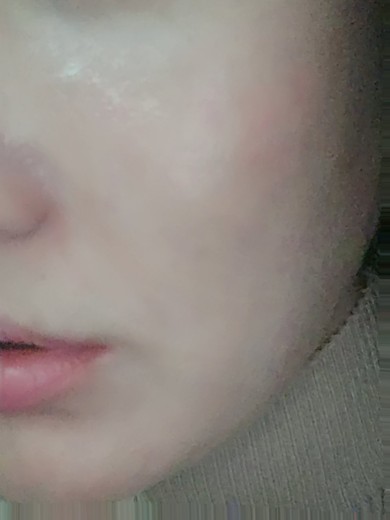 after photo: 쥬베룩