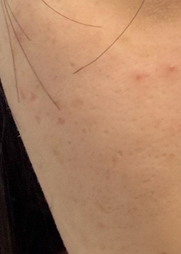 after photo: 쥬베룩