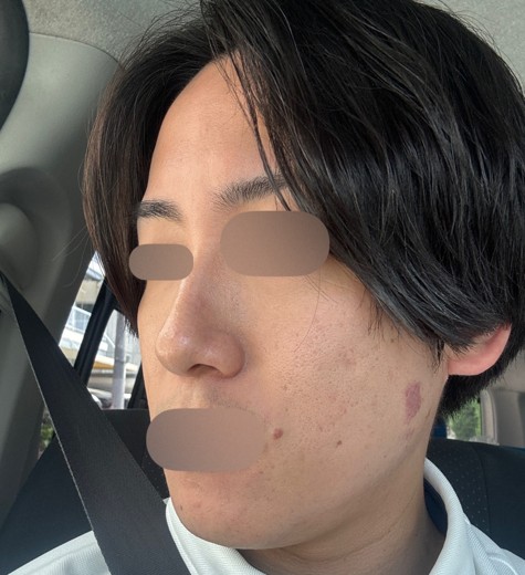 after photo: ポテンツァ(POTENZA)