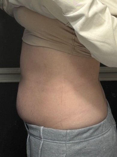 before photo: マンジャロ