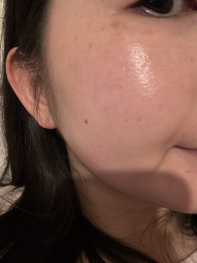 after photo: 診断・検査