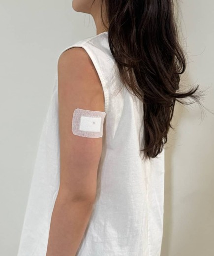 after photo: 팔지방분해주사