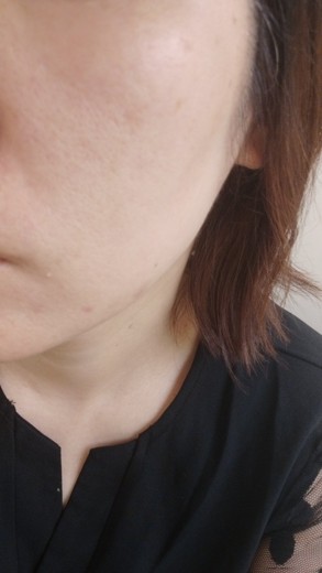 before photo: ポテンツァ(POTENZA), ジュベルック(Juvelook)