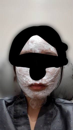 before photo: 脂肪溶解注射(腕), 脂肪溶解注射(太もも)