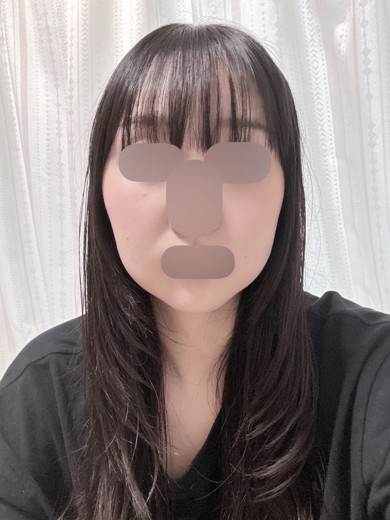 after photo: 脂肪溶解注射(顔)