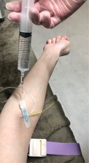 after photo: ビタミン注射・点滴
