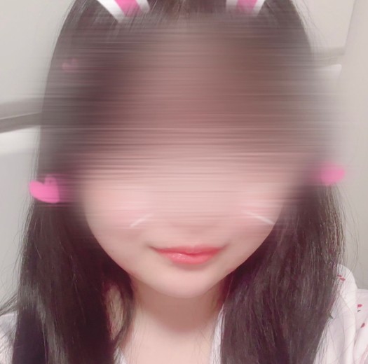 after photo: インモード