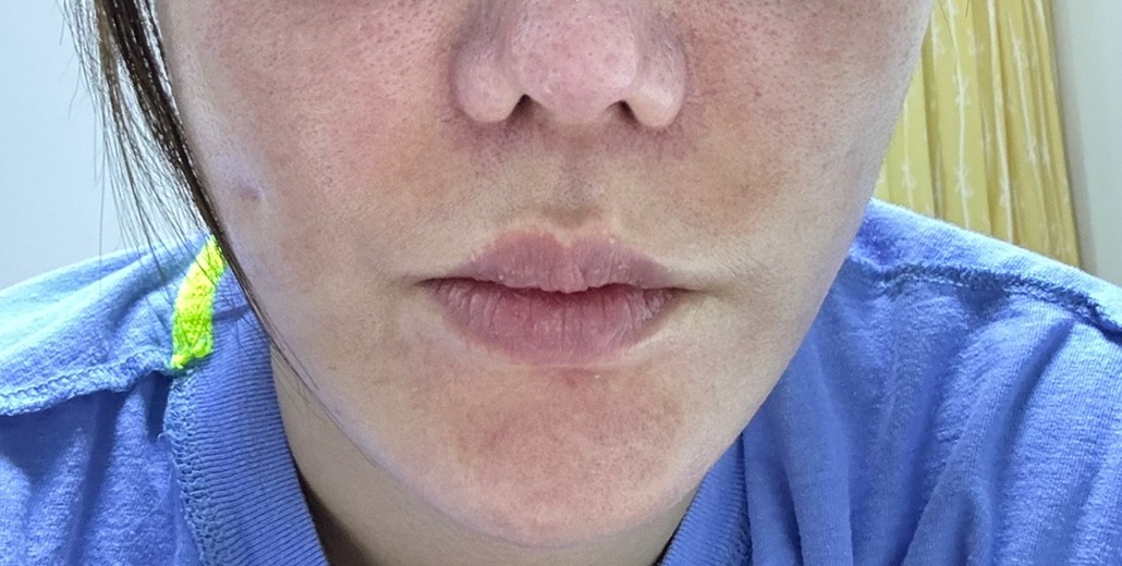 after photo: 엘라비에리투오