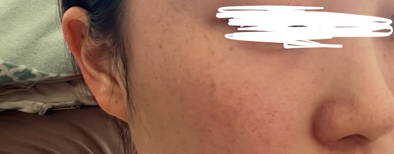before photo: ルメッカ