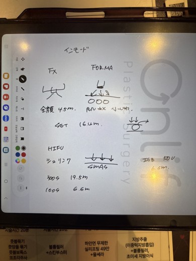 before photo: インモード