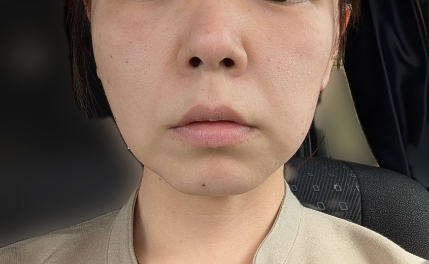 before photo: ソノクイーン(ハイフ)