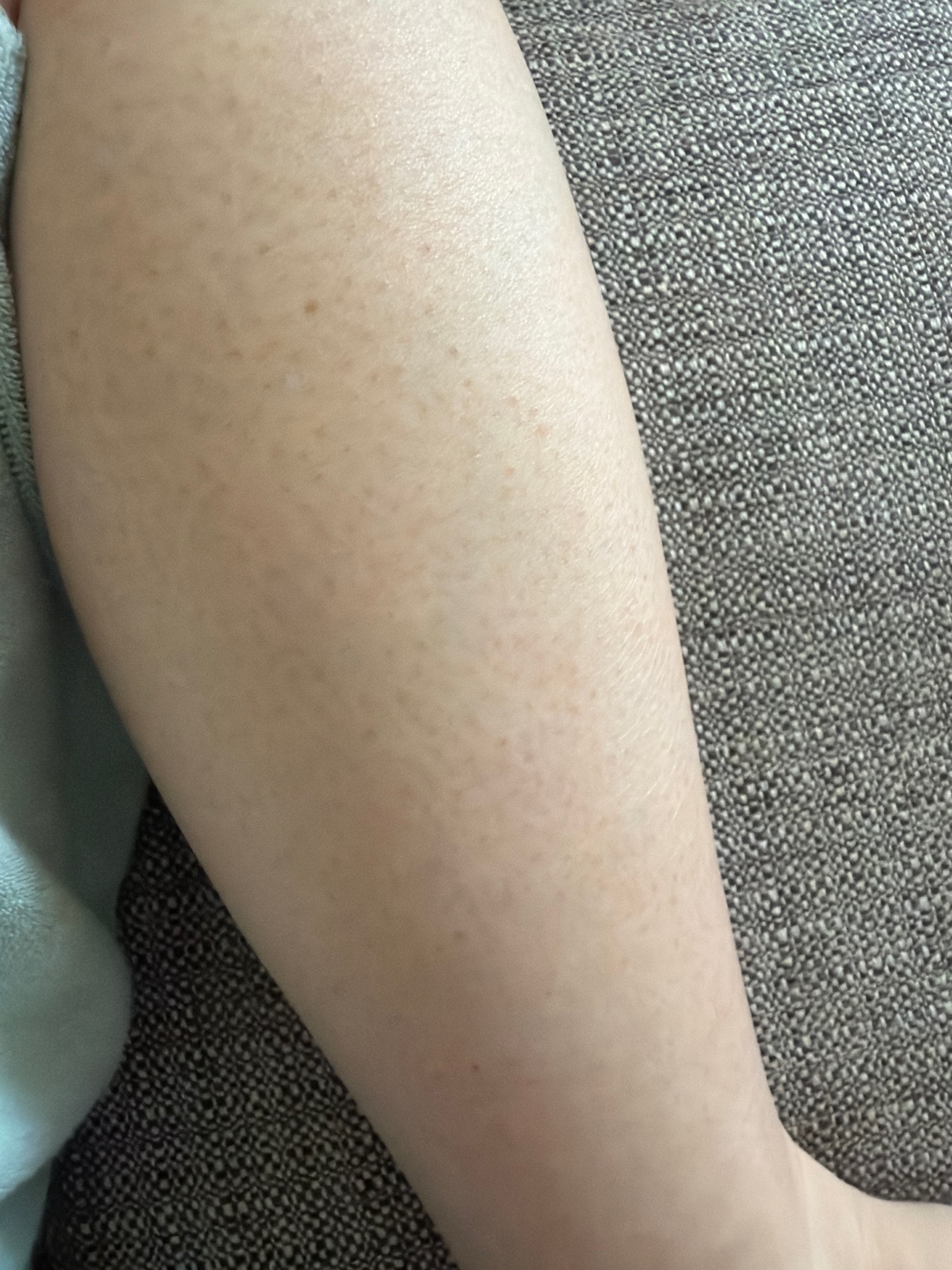 何度でも可】【女性限定】全身脱毛｜ジェントルマックスプロ