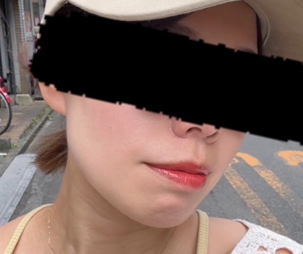 after photo: ボルニューマ