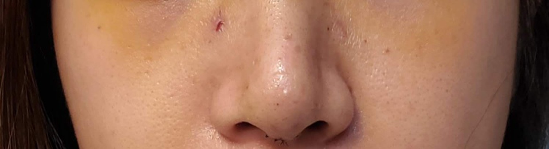 ヴェリテクリニック大阪院の施術口コミ113件, image size:1916x520