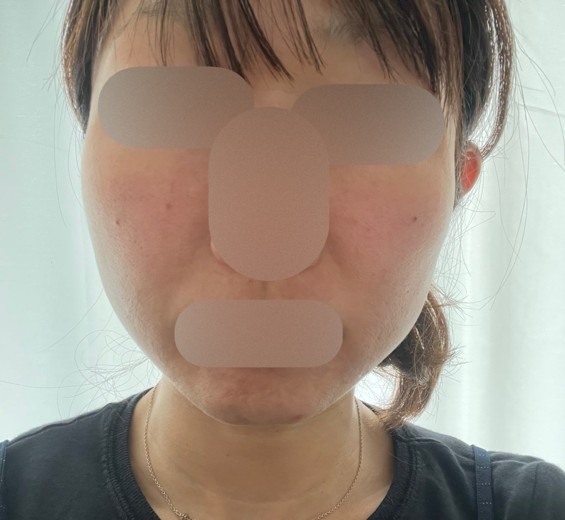 before photo: ポテンツァ(POTENZA), マックーム(McCoom)