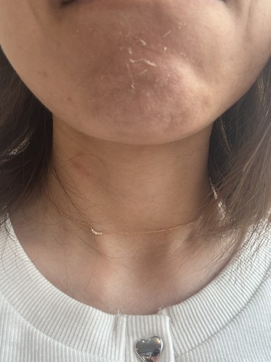 after photo: ルメッカ