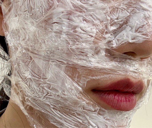 after photo: 리쥬란힐러