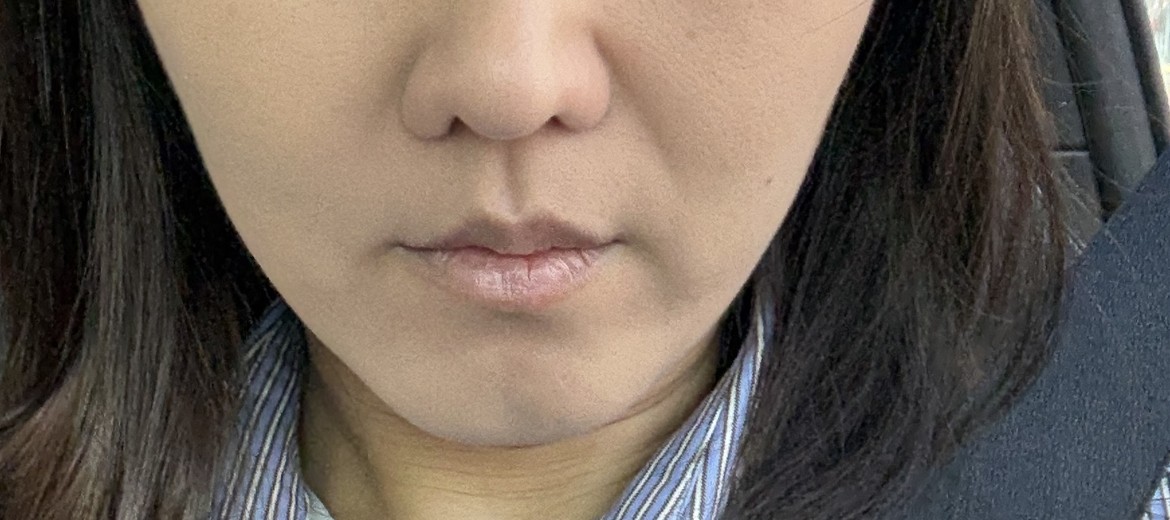 before photo: 쥬베룩