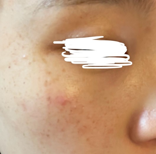 after photo: ルメッカ