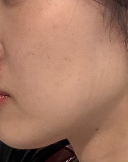 before photo: ルメッカ