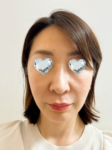 after photo: ボルニューマ