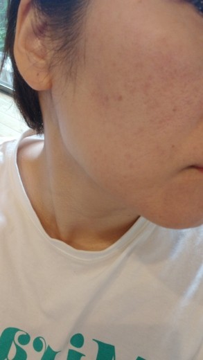 after photo: ポテンツァ(POTENZA), ジュベルック(Juvelook)