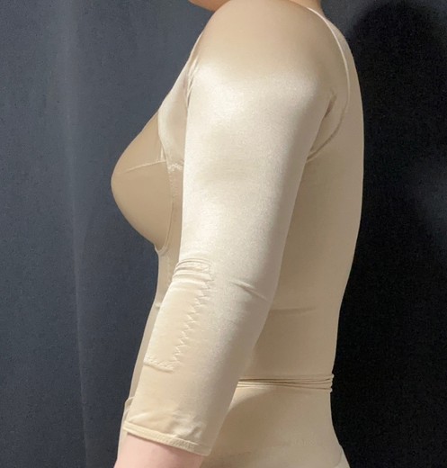 after photo: 전신지방흡입