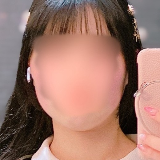 before photo: 脂肪溶解注射(顔)