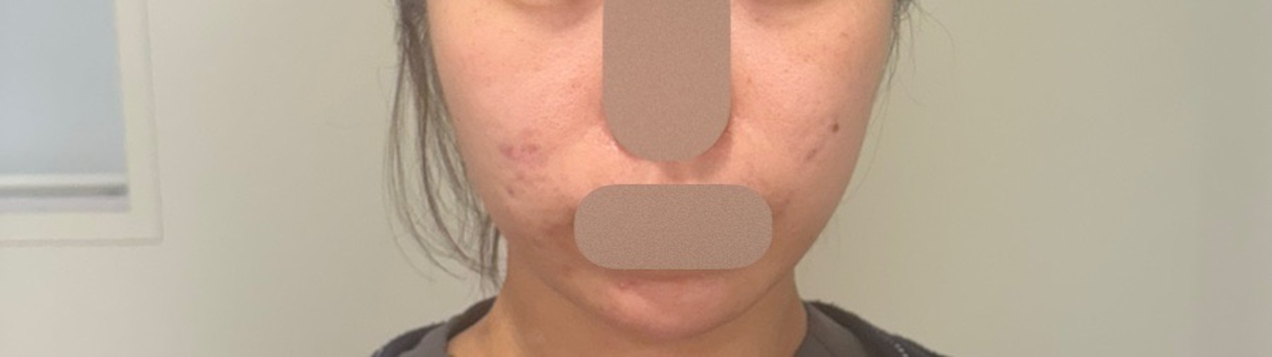 after photo: 슈링크유니버스