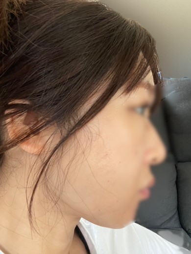 before photo: ルメッカ