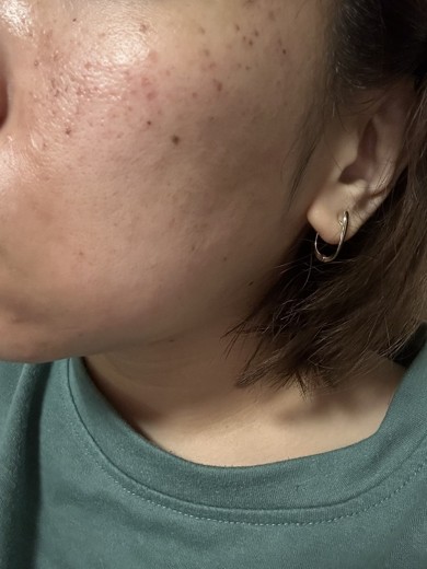 after photo: ルメッカ