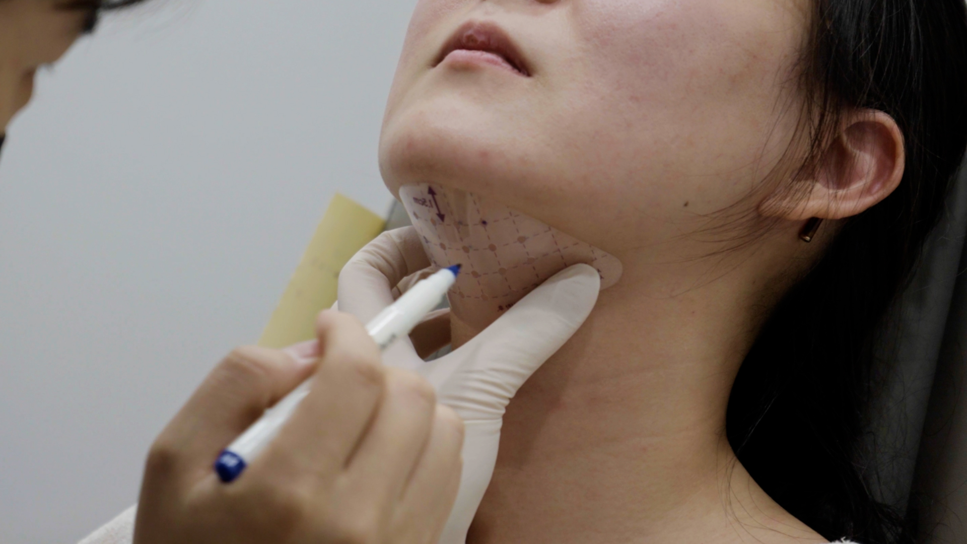 脂肪溶解注射の施術・口コミ・クリニック情報(2025) | カンナムオンニ